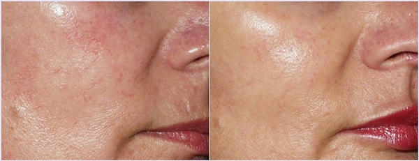 Software: Microsoft Office